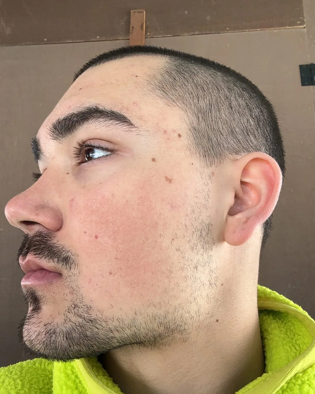 A close side-profile portrait.
