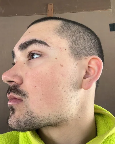 A close side-profile portrait.